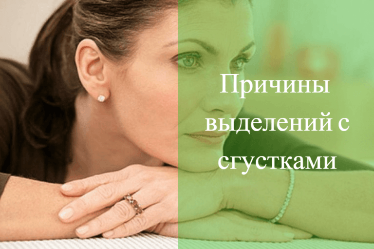 🤷 Причины появления коричневых сгустков 🚩 вместо месячных