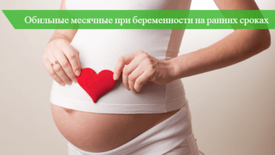 обильные месячные при беременности