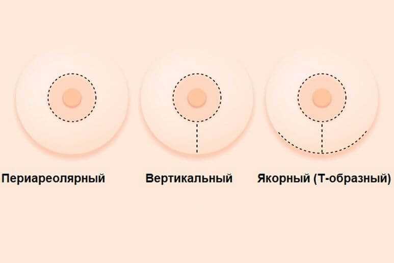 Преимущества регулярных тренировок два-три раза в неделю